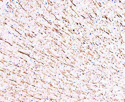 2 - Anti-MAP1 Antibody (Monoclonal, HM-1) ABO10445