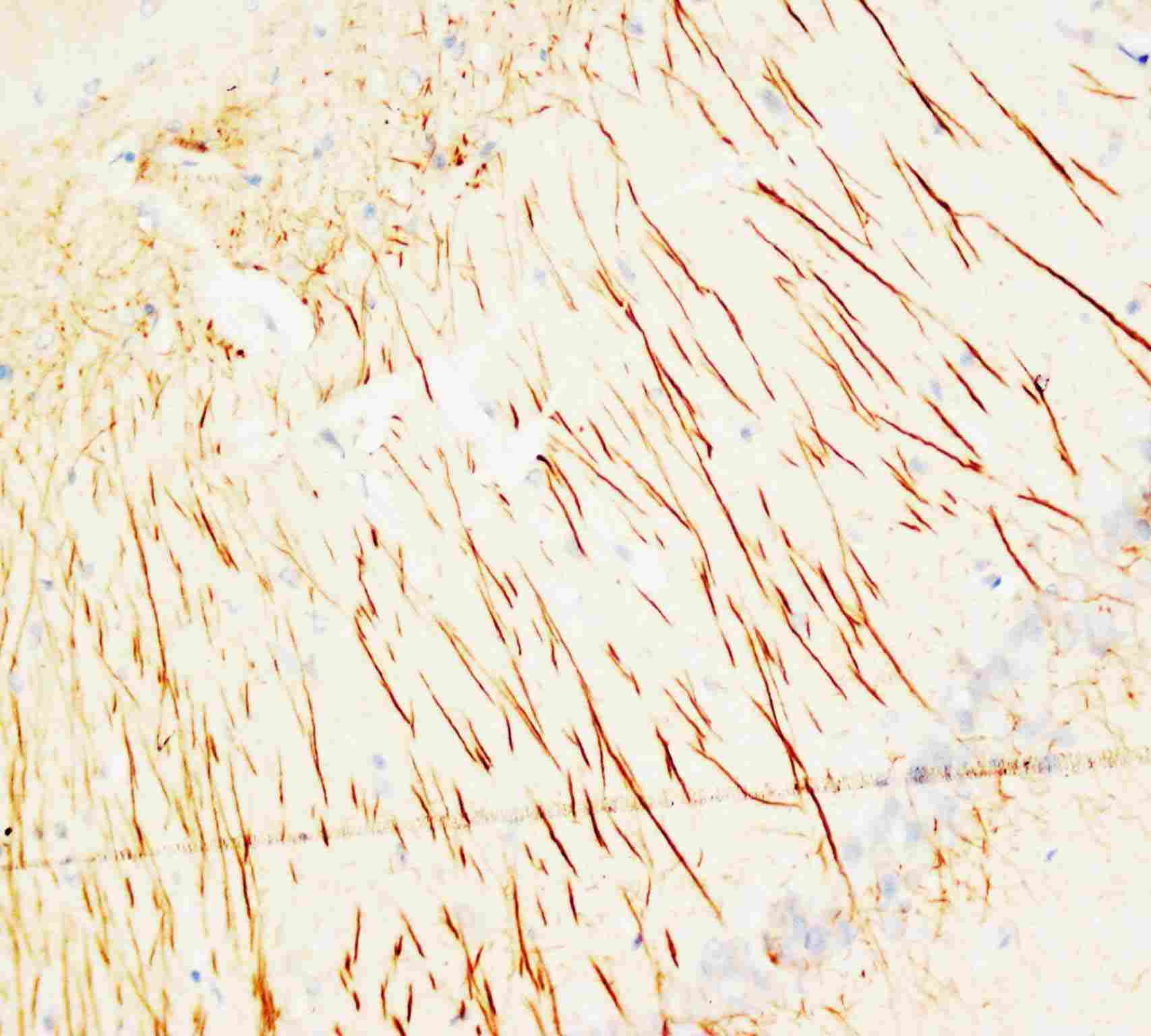 2 - Anti-MAP2 Antibody (Monoclonal, HM-2) ABO10446