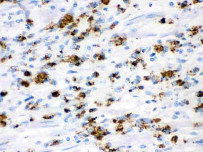 2 - Anti-Mucin Gastric Antibody (Monoclonal, 45M1) ABO10449
