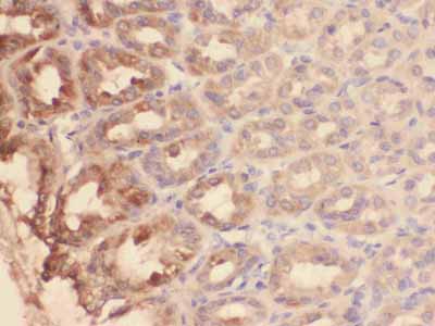 2 - Anti-Mucin Gastric Antibody (Monoclonal, 45M1) ABO10449