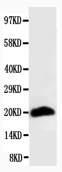 1 - Anti-Myosin(Skeletal, Fast) Antibody (Monoclonal, MY-32) ABO10451