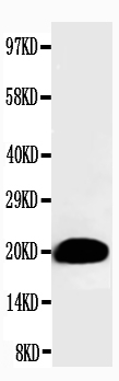 1 - Anti-Myosin(Skeletal, Slow) Antibody (Monoclonal, NOQ7.5.4D) ABO10452