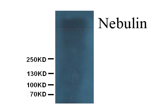 1 - Anti-Nebulin Antibody (Monoclonal, NB2) ABO10455