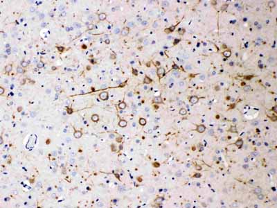 2 - Anti-NEFH Antibody (Monoclonal, N52) ABO10457
