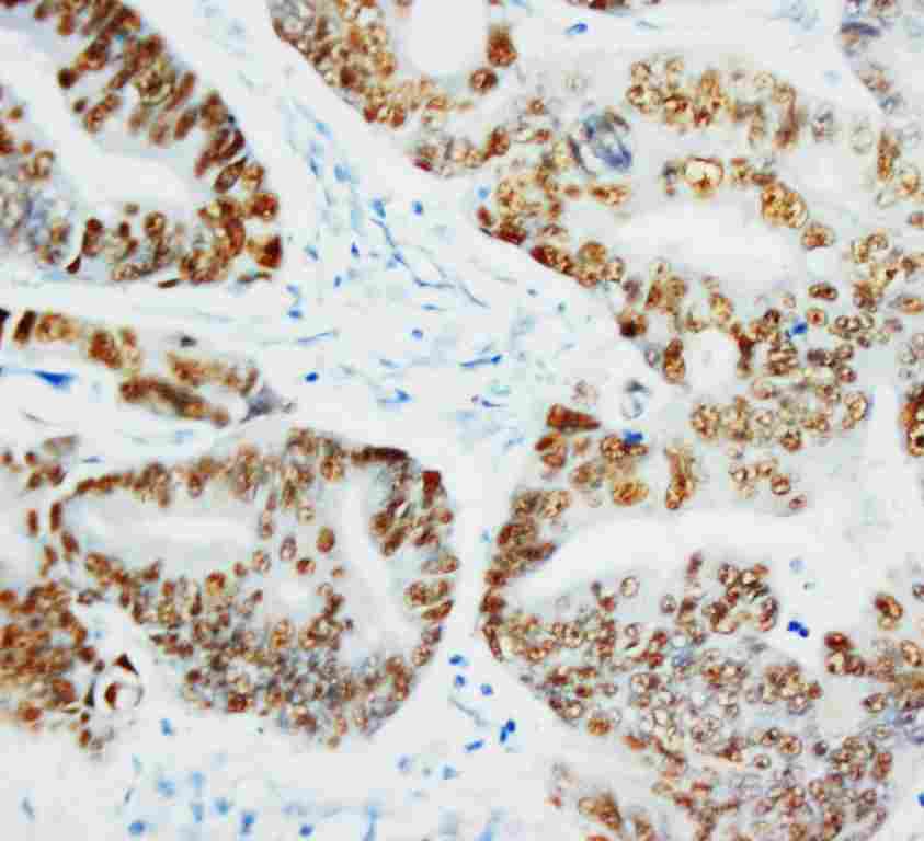 2 - Anti-P53 Antibody ABO10463