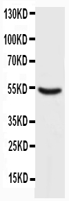1 - Anti-P53 Antibody ABO10463