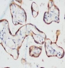 2 - Anti-PCK Antibody (Monoclonal, C-11+PCK-26+CY-90+KS-1A3+M20+A53-B/A2) ABO10466