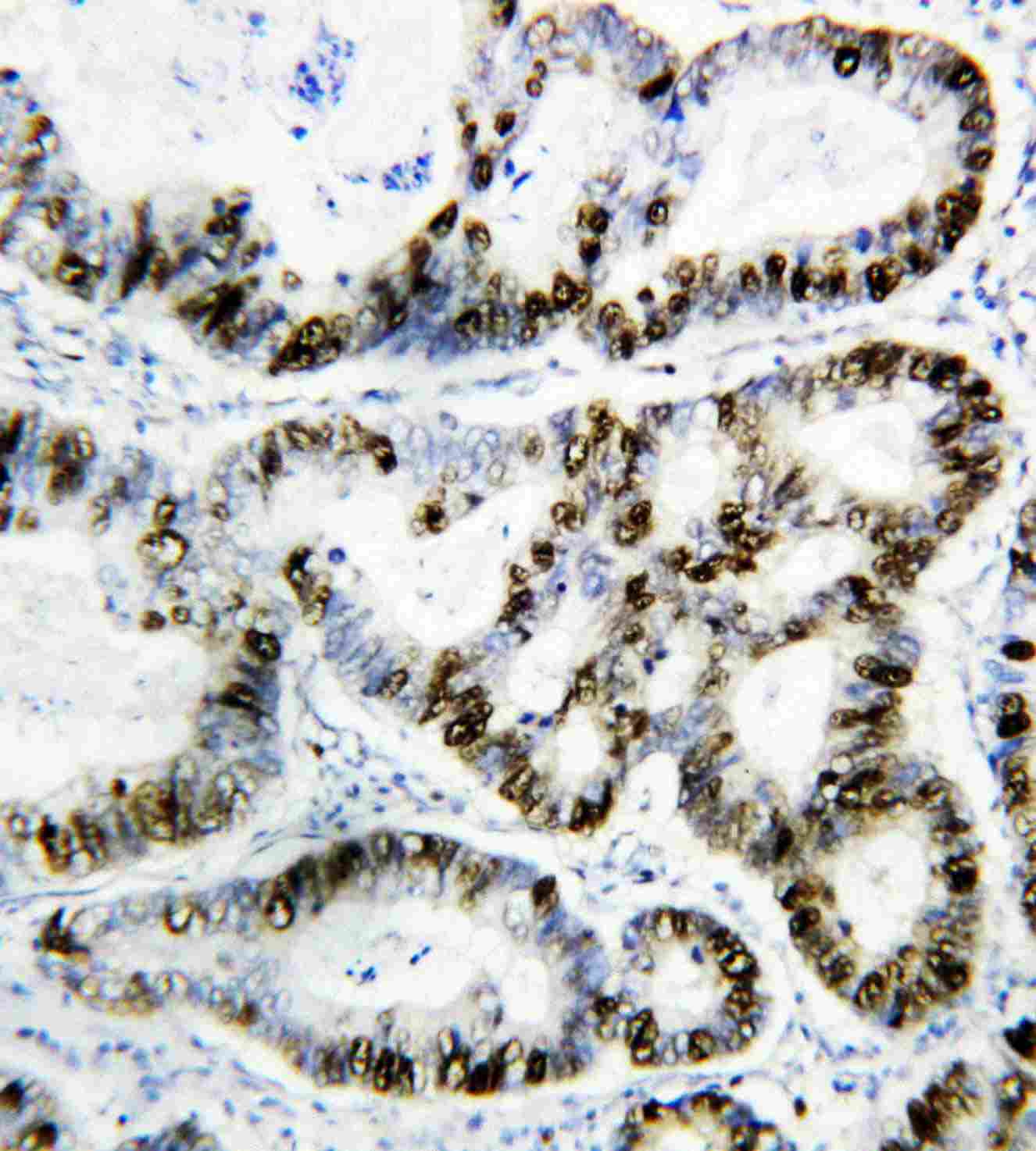 2 - Anti-PCNA Antibody (Monoclonal, PC 10) ABO10468