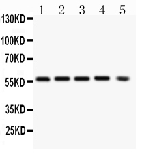 1 - Anti-PKB Alpha Antibody (Monoclonal, PKB-175) ABO10470