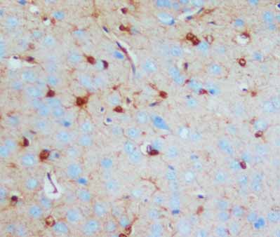 2 - Anti-S-100(Beta-subunit) Antibody (Monoclonal, SH-B1) ABO10472