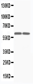 1 - Anti-Smad4(DPC4) Antibody (Monoclonal, DCS-46) ABO10473