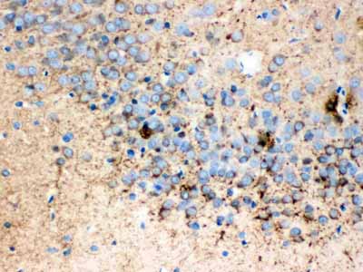 2 - Anti-Synaptophysin Antibody (Monoclonal, SVP-38) ABO10475