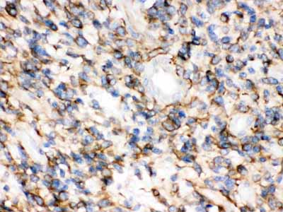 2 - Anti-Synaptophysin Antibody (Monoclonal, SVP-38) ABO10475