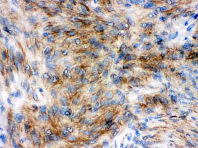 2 - Anti-Synaptophysin Antibody (Monoclonal, SVP-38) ABO10475