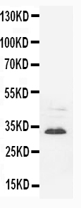 1 - Anti-Synaptophysin Antibody (Monoclonal, SVP-38) ABO10475