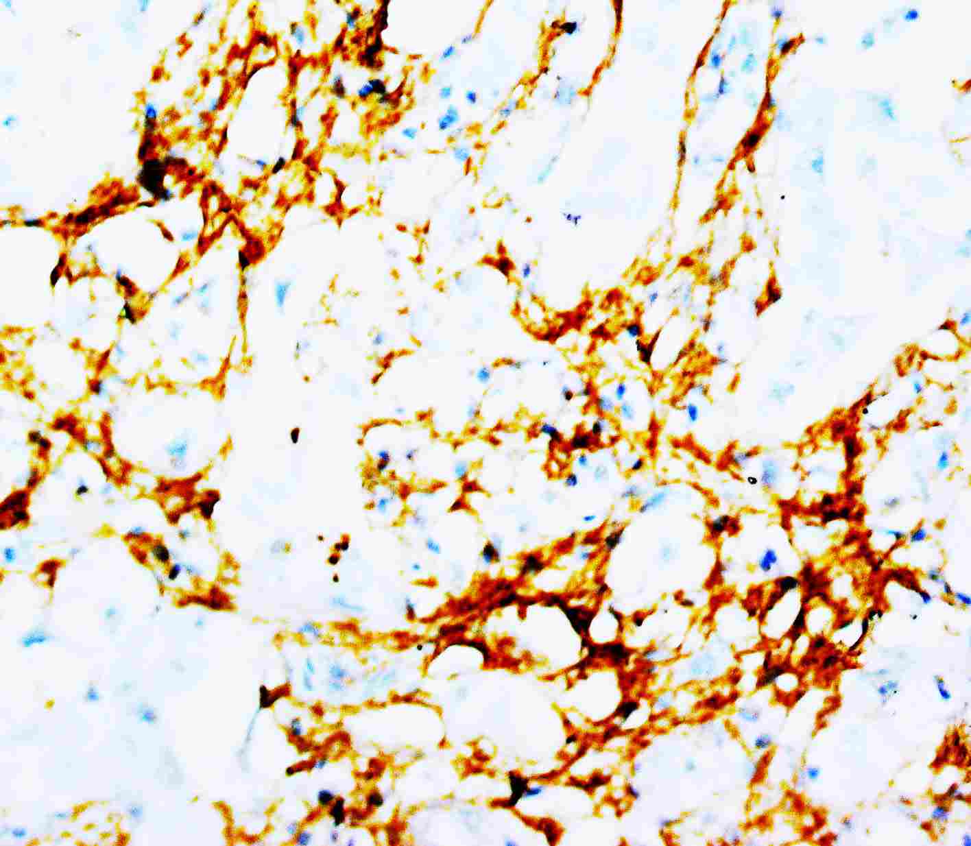 2 - Anti-Tenascin Antibody (Monoclonal, BC-24) ABO10478