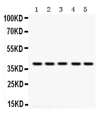 1 - Anti-Tropomyosin(36/39 kDa) Antibody (Monoclonal, TM31) ABO10479