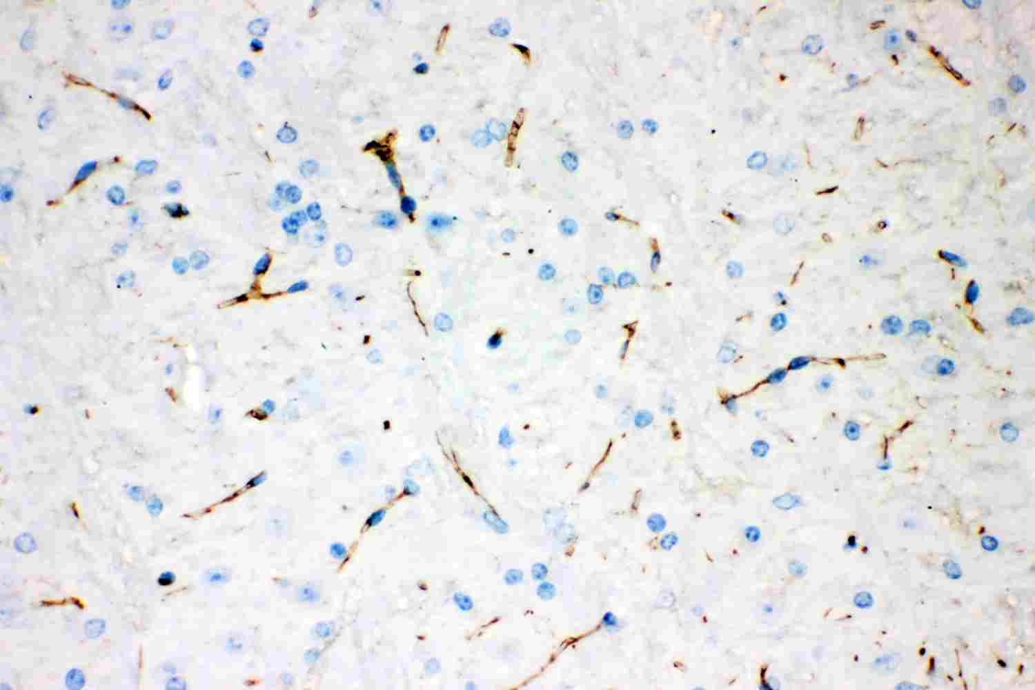 2 - Anti-Tyrosine Hydroxylase Antibody (Monoclonal, TH-16) ABO10484