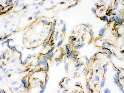 2 - Anti-Vinculin Antibody (Monoclonal, hVIN-1) ABO10486