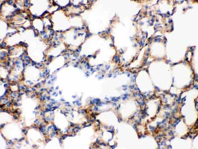 2 - Anti-Alpha-Actinin Antibody (Monoclonal, EA-53) ABO10487