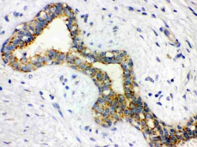 2 - Anti-Alpha-Actinin Antibody (Monoclonal, EA-53) ABO10487