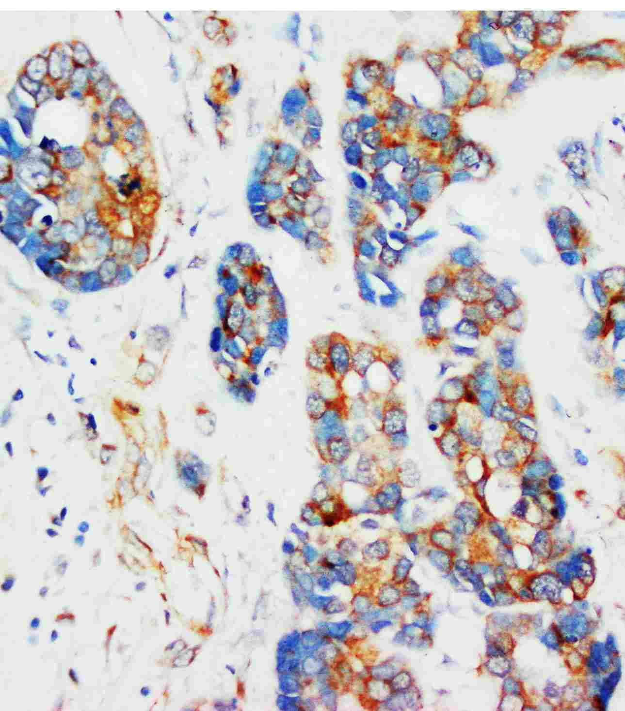 2 - Anti-Alpha-Tubulin Antibody (Monoclonal, DM1A) ABO10490
