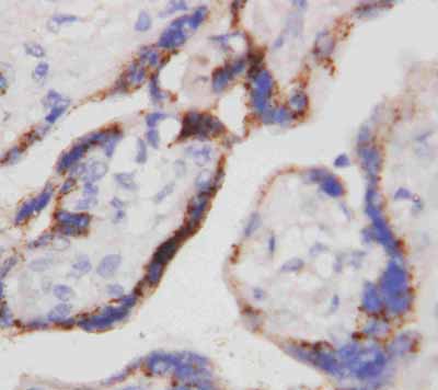 2 - Anti-Beta-HCG Antibody (Monoclonal, PC-2) ABO10491