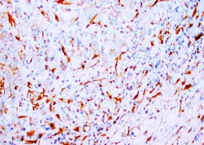 2 - Anti-Beta-Tubulin Antibody (Monoclonal, TUB 2.1) ABO10492
