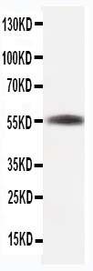 1 - Anti-Beta-Tubulin Antibody (Monoclonal, TUB 2.1) ABO10492