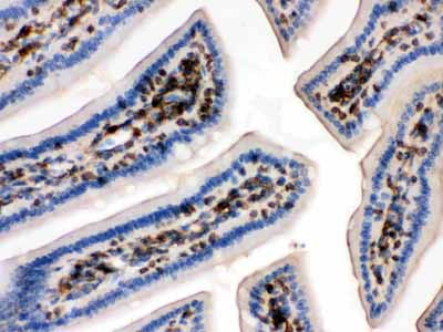 2 - Anti-Beta-Actin Antibody (Monoclonal, AC-15) ABO10494