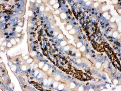 2 - Anti-Beta-Actin Antibody (Monoclonal, AC-15) ABO10494