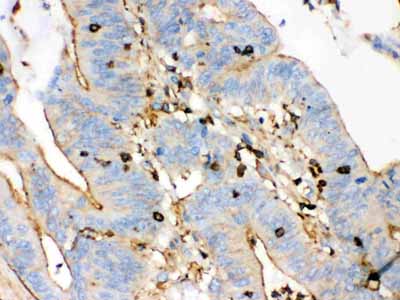 2 - Anti-Beta-Actin Antibody (Monoclonal, AC-15) ABO10494