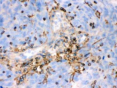 2 - Anti-Beta-Actin Antibody (Monoclonal, AC-15) ABO10494