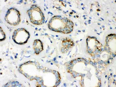 2 - Anti-Beta-Actin Antibody (Monoclonal, AC-15) ABO10494