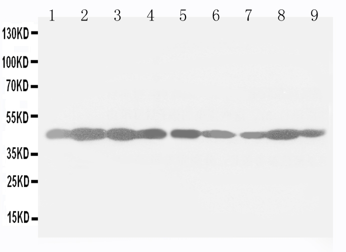 1 - Anti-Beta-Actin Antibody (Monoclonal, AC-15) ABO10494