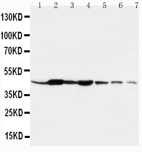 1 - Anti-Beta-Actin Antibody (Monoclonal, AC-15) ABO10494