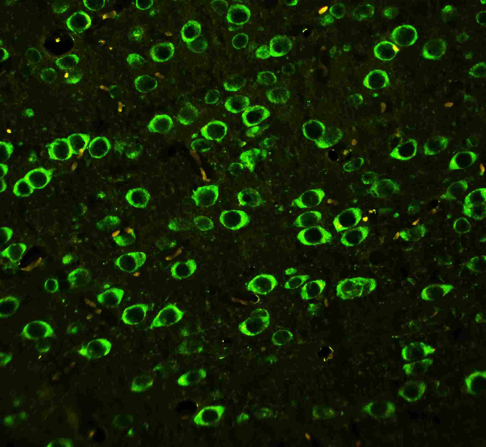 2 - Anti-ABI1 Antibody ABO10496