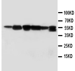1 - Anti-ABI1 Antibody ABO10496