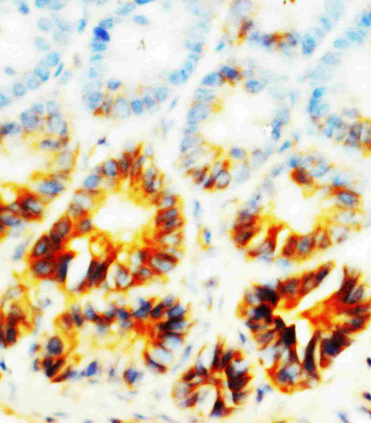 2 - Anti-Alkaline Phosphatase Antibody ABO10497
