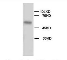 1 - Anti-Alkaline Phosphatase Antibody ABO10497