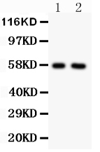 1 - Anti-Alkaline Phosphatase Antibody ABO10498