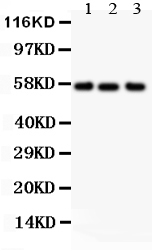 1 - Anti-Alkaline Phosphatase Antibody ABO10499