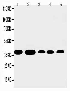 1 - Anti-Annexin A1 Antibody ABO10501