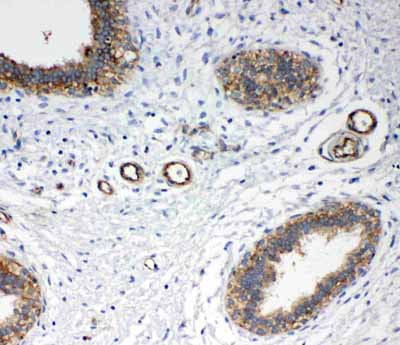 2 - Anti-Annexin IV Antibody ABO10502