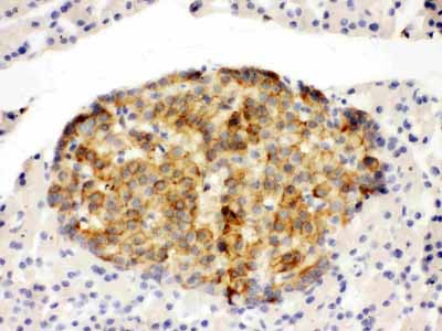 2 - Anti-Annexin IV Antibody ABO10502