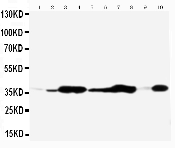 1 - Anti-Annexin V Antibody ABO10503