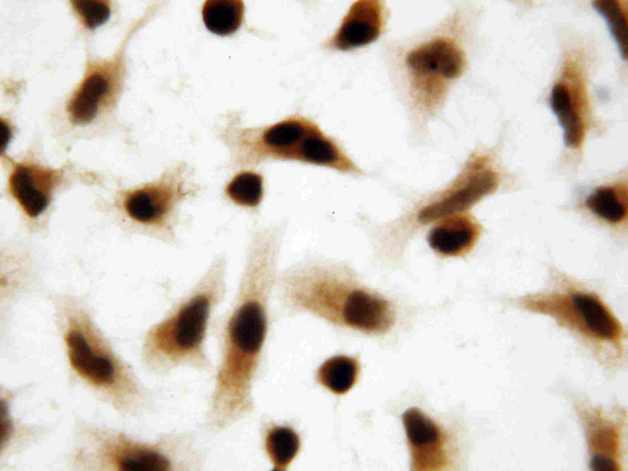 8 - Anti-Apoptosis Inhibitor 5 Antibody ABO10504