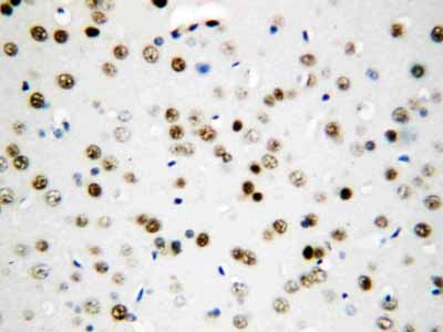 2 - Anti-Apoptosis Inhibitor 5 Antibody ABO10504
