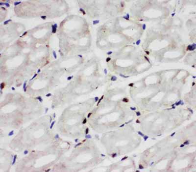 2 - Anti-Apoptosis Inhibitor 5 Antibody ABO10504