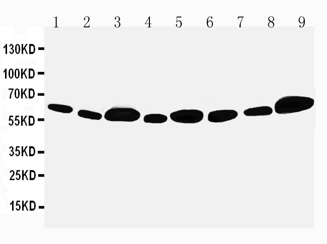1 - Anti-Apoptosis Inhibitor 5 Antibody ABO10504